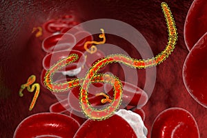 Ebola viruses in blood of a patient with Ebola hemorrhagic fever