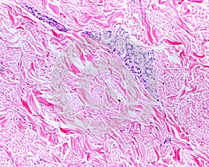 Eccrine sweat gland