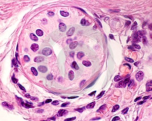 Eccrine sweat gland. Excretory duct