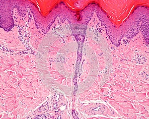 Eccrine sweat gland. Excretory duct