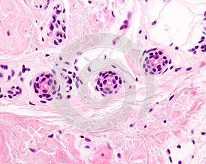 Eccrine sweat gland. Excretory duct photo