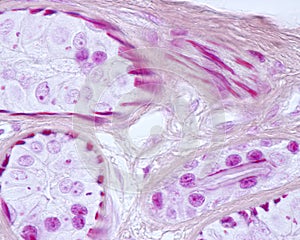 Eccrine sweat gland. Myoepithelial cells