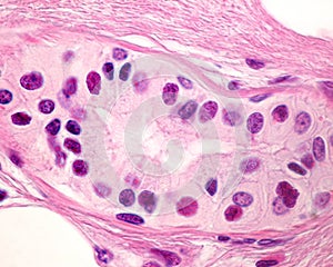 Eccrine sweat gland. Secretory tubule