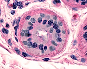 Eccrine sweat gland. Secretory tubule