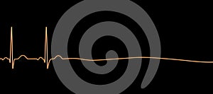 ECG in asystole, 3D illustration