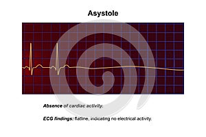 ECG in asystole, 3D illustration