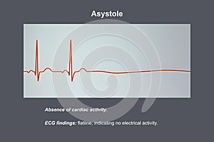 ECG in asystole, 3D illustration