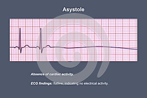 ECG in asystole, 3D illustration