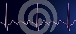 ECG in atrial flutter, 3D illustration