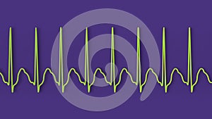 ECG in atrial flutter, 3D illustration