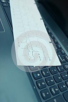 ECG chart on the keyboard concept of medical monitoring