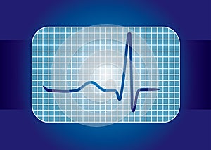 ECG curve