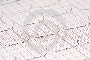 ECG diagram