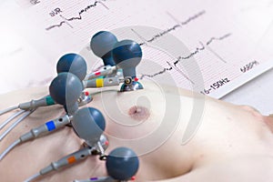 ECG or EKG Legs of man with electrodes for electrocardiogram rec