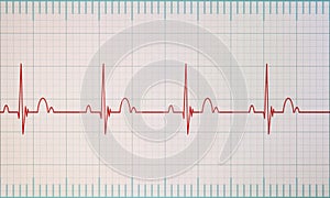 ECG / EKG monitor