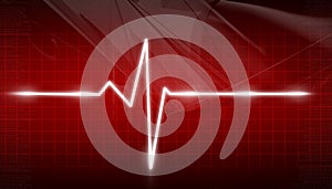 ECG Electrocardiogram