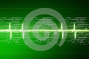 ECG Electrocardiogram