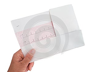 ECG, electrocardiogram being delivered, in senior female hand.