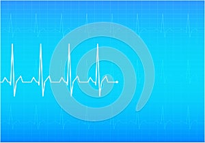 ECG Electrocardiogram,
