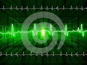 ECG Electrocardiography