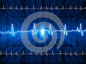 ECG Electrocardiography