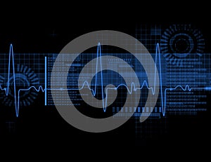 ECG Electrocardiography