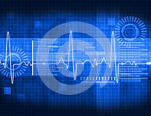 ECG Electrocardiography