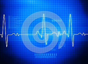 ECG Electrocardiography