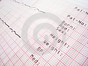 ECG electrocardiography