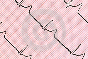 ECG graph