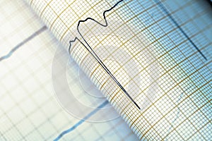 ECG graph, medical textured background