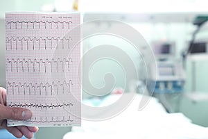 ECG with a heart attack in hospital ward