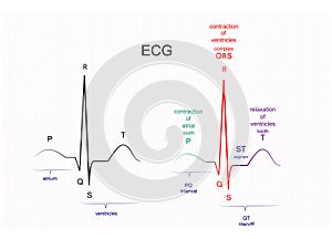 The ECG interpretation