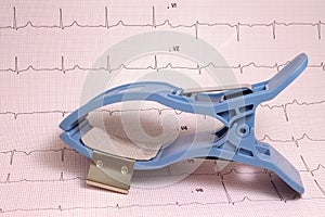 ECG limb electrode on ECG paper with record