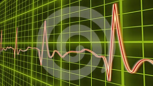 ECG line graph, heart beating in normal sinus rhythm, healthcare and medicine