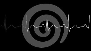 ECG looping.PNG Alpha.Normal Sinus Rhythm.Heart rate. Heart beat line template.Cardiogram monitor.