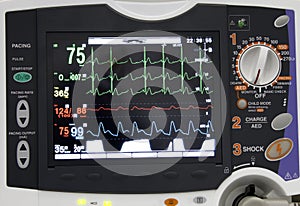 ECG monitor