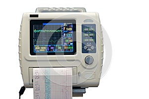 ECG monitor