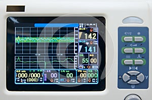 ECG monitor photo