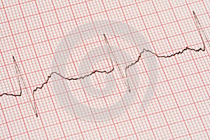 ECG printout photo