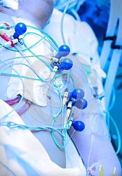 ECG recording. Cardiographic machine electrodes on the patient.