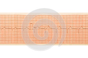 ECG test results on millimeter paper, heart rhythm results