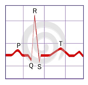 ECG trace