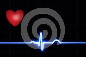 ECG trace