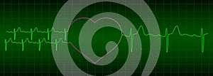 ECG from two hearts after love to one heart