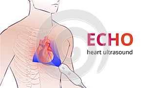 Echocardiography technique. Phase array ultrasound transducer is placed on the person`s chest