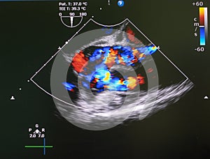 Echocardiography ultrasound machine.