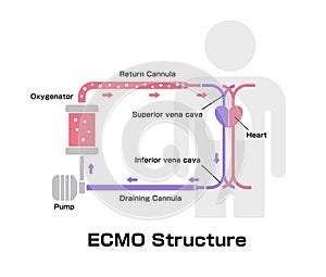 ECMO  Extracorporeal membrane oxygenation  structure vector illustration