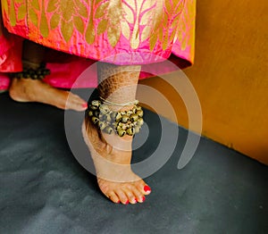 Eczema skin disorder girl wearing anklets