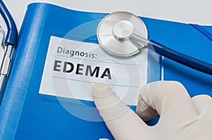 Edema - lymphatic diagnosis on blue folder with stethoscope photo